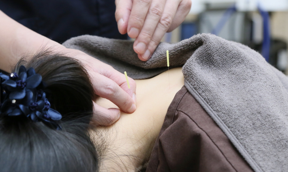 玉名市で頭痛に対する鍼灸施術を行うはりねずみ鍼灸整骨院