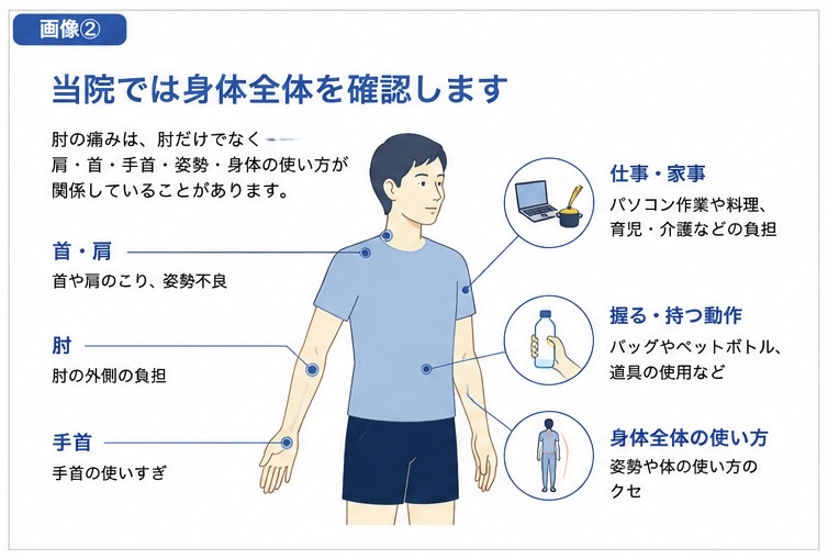 テニス肘で肩や手首など身体全体を確認するイメージ図