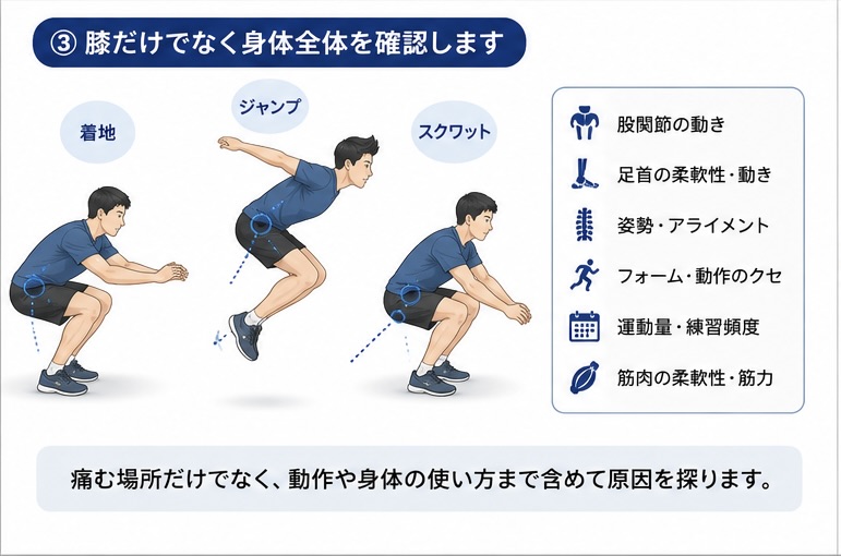 ジャンパー膝で膝だけでなく股関節・足首・姿勢・動作を確認する図