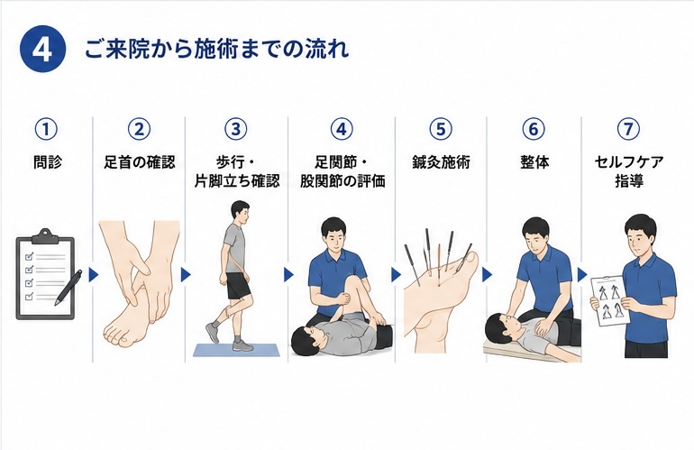 足関節不安定症の確認から施術までの流れ