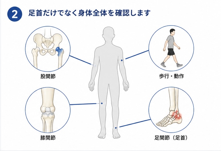 足関節不安定症で身体全体のバランスを確認するイメージ