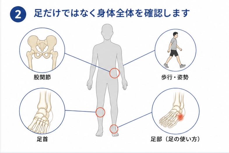 外反母趾で身体全体を確認するイメージ