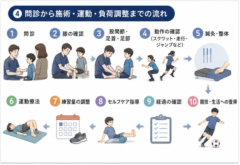 オスグッド病の問診から鍼灸・整体・運動・負荷調整までの流れ