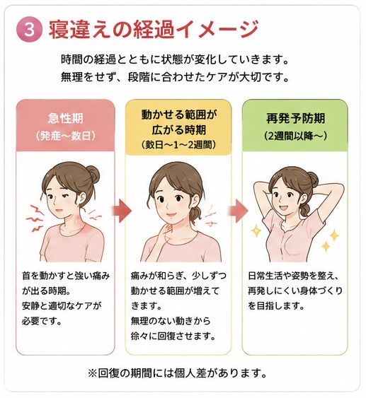 寝違えの急性期・回復期・再発予防期の流れの図解