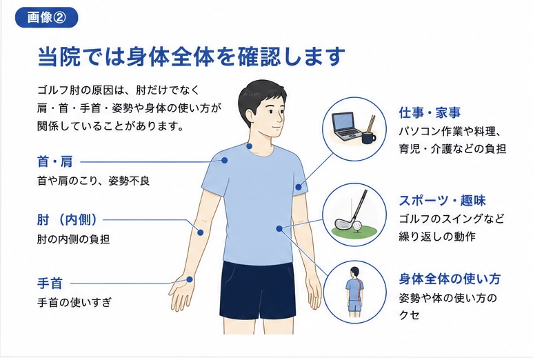 ゴルフ肘で肩や手首など身体全体を確認するイメージ図