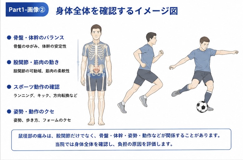グロインペイン症候群で身体全体の動きやスポーツ動作を確認するイメージ図