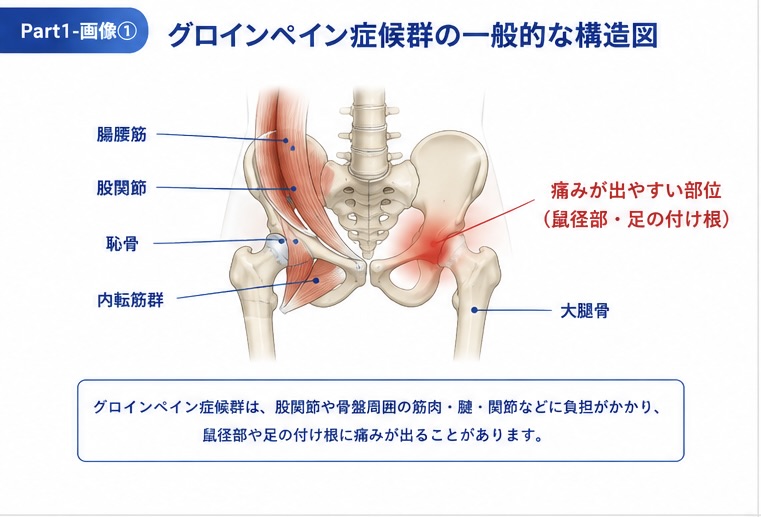 グロインペイン症候群で痛みが出やすい股関節・鼠径部の一般的な構造図