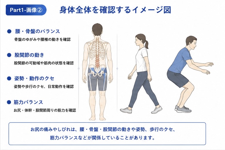 梨状筋症候群で身体全体のバランスや歩行を確認するイメージ