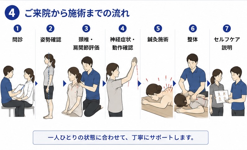 頚椎症の確認から施術までの流れ