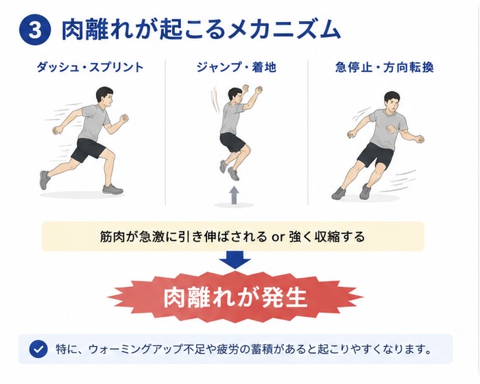 肉離れで身体全体のバランスや歩行を確認する様子