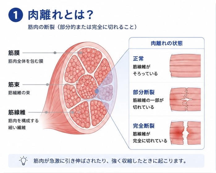 肉離れの確認から施術・セルフケアまでの流れ