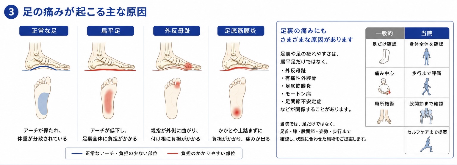 足の痛みにつながる代表的な原因の一般的な比較図
