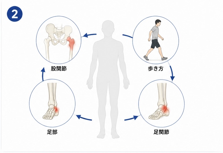 有痛性外脛骨で身体全体のバランスや歩行を確認する様子